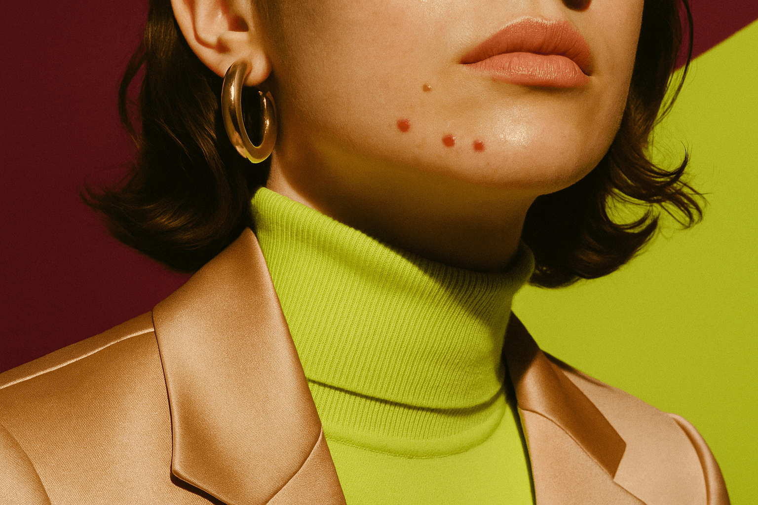 Jawline acne that won't quit? It's not your skincare. It's your hormones.